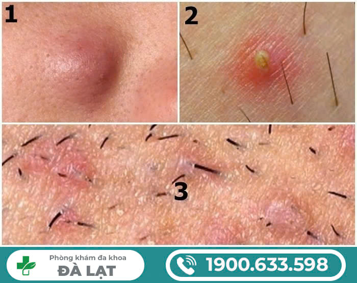 Hình ảnh minh họa